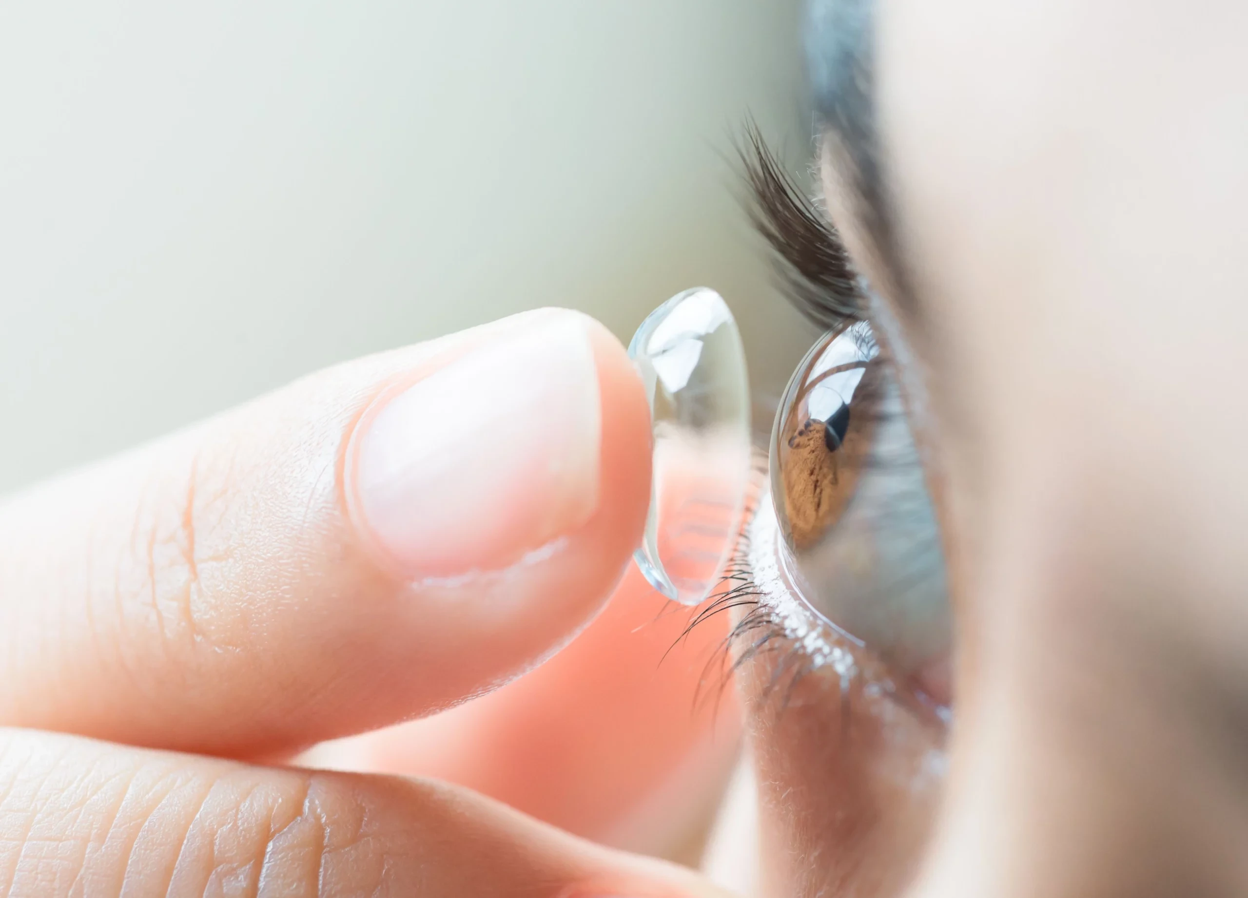 Pengguna Lensa Kontak Wajib Tahu: Tips Aman Mencegah Keratitis